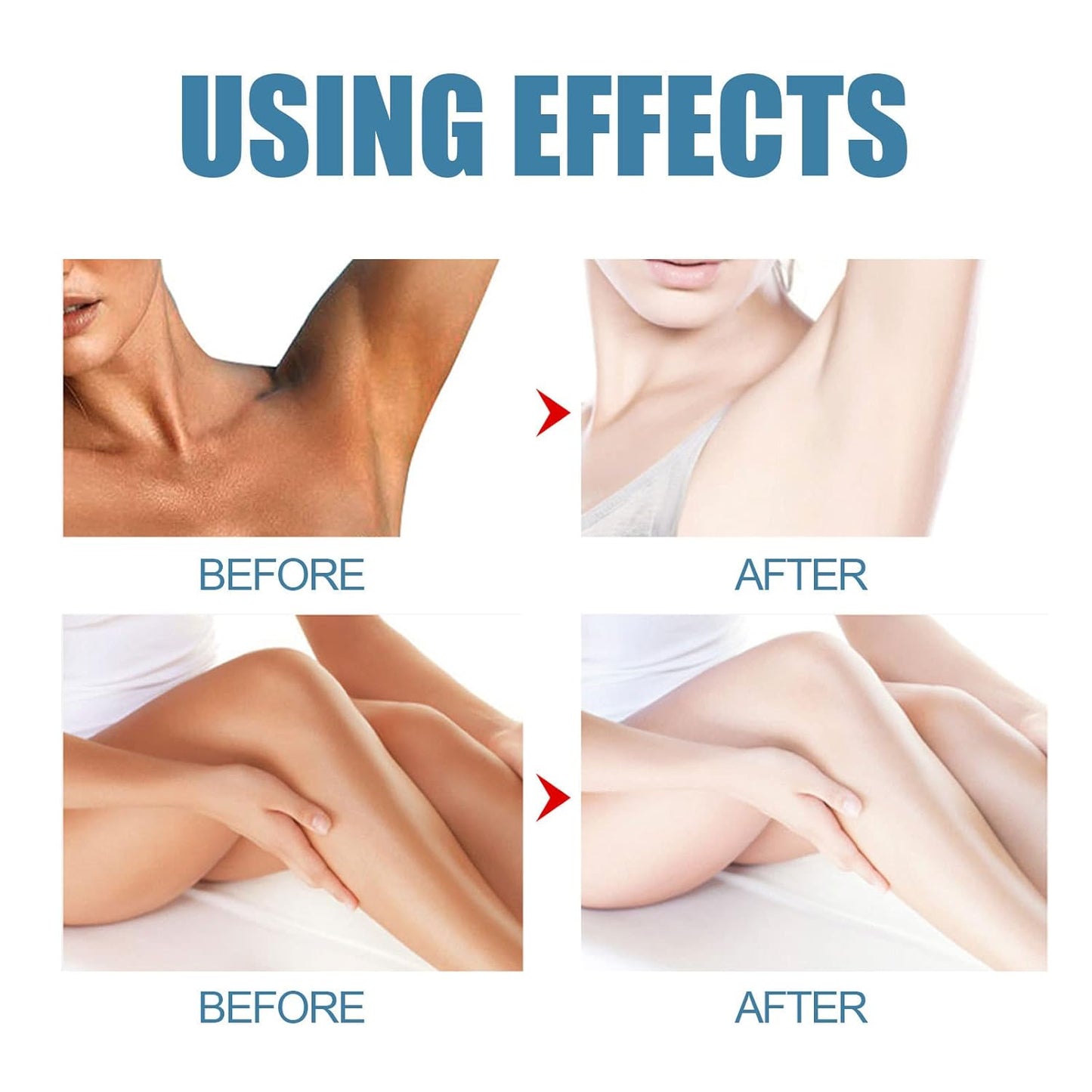 SkinLumy™ Exfoliating Whitening Cream (Pack of 2)